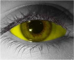 Yellow Sclera Contact Lenses 22mm – Gothika Custom – Pair